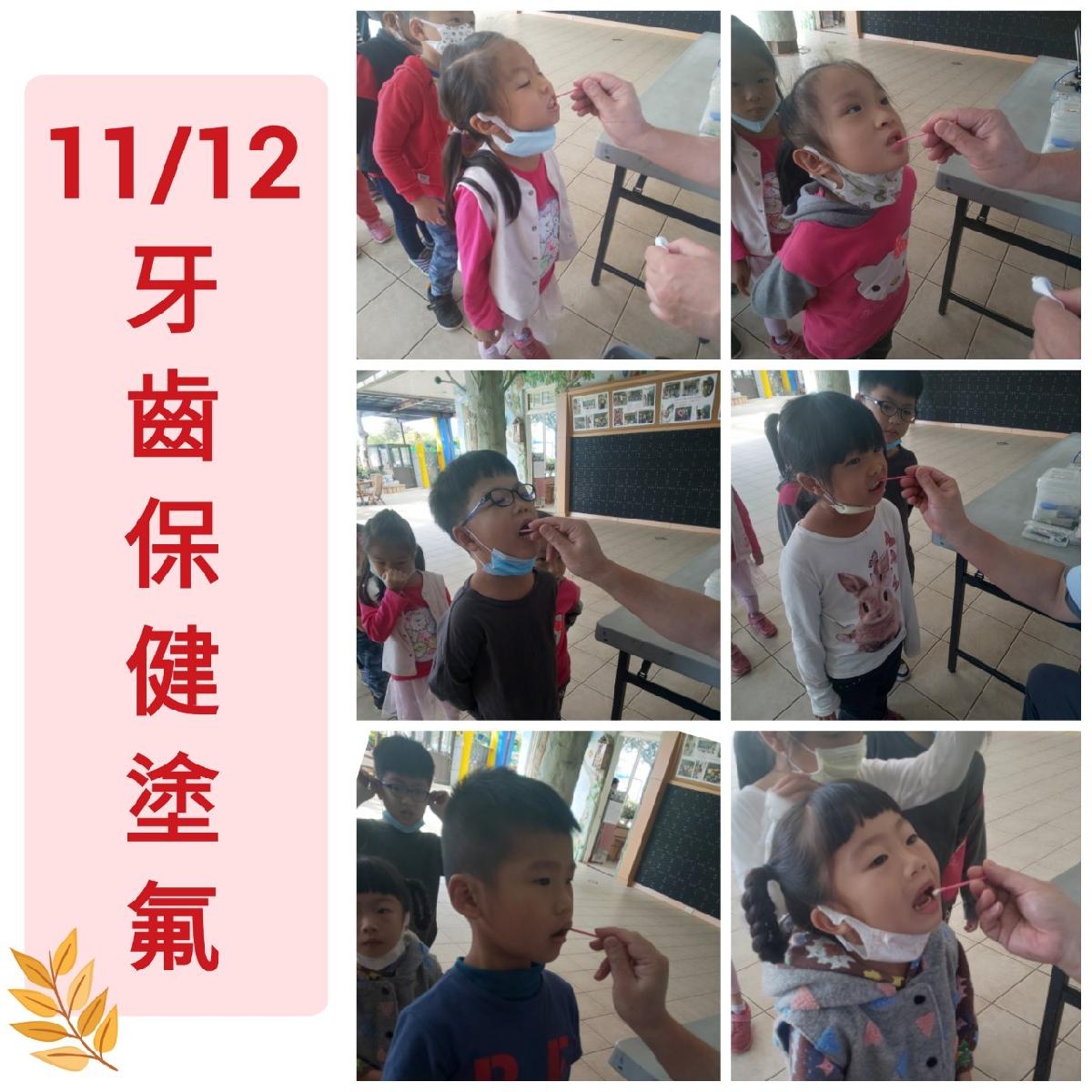 109-11-12~口腔保健~塗氟